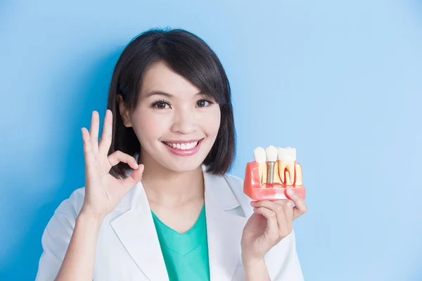 Dentista mostrando diente de implante — Foto de Stock