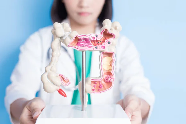 Doctor with colorectal cancer model — Stock Photo, Image