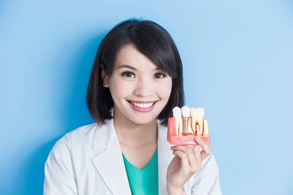 Dentista con modelo de diente de implante — Foto de Stock