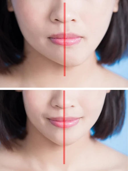 исправление контура губ. красивые мужские губы. тонкая верхняя губа и пухлая нижняя. губа выше другой. аугментация губ форма чайка.