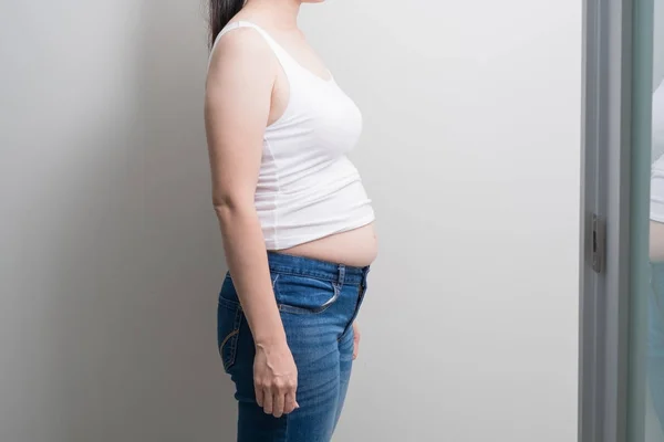 Товста жінка надмірна вага — стокове фото