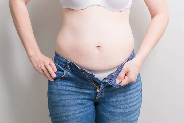 Mujer gorda con sobrepeso —  Fotos de Stock