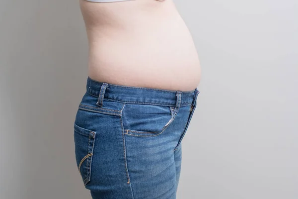 Gordura mulher com excesso de peso — Fotografia de Stock