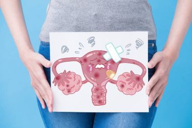 woman take unhealthy  uterus billboard on the blue background clipart