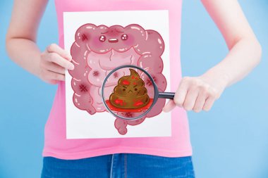 woman with  unhealthy  intestine billboard and magnifying on the blue background clipart