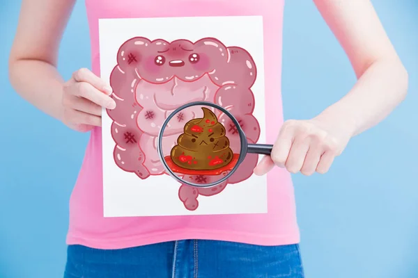 Mujer Con Cartelera Intestino Insalubre Aumento Fondo Azul — Foto de Stock