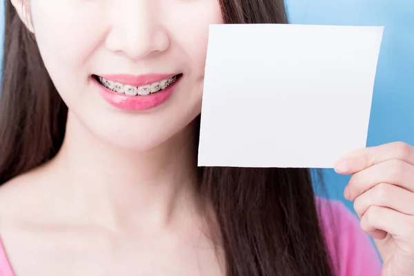 Close Woman Wearing Braces Holding Paper Blue Background — Stock Photo, Image