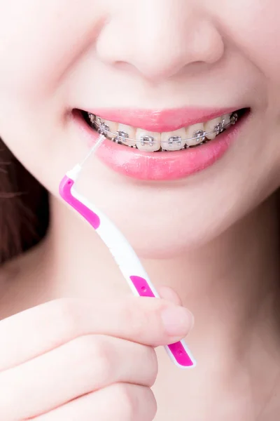 Diş Teli Takan Fırça Tutan Kadının Yakın Çekim — Stok fotoğraf