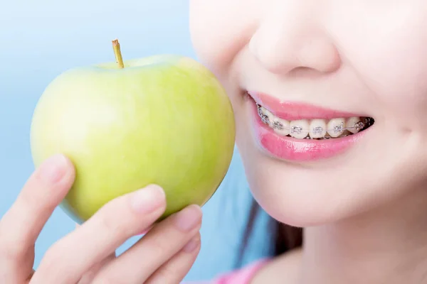 Primer Plano Mujer Usando Aparatos Ortopédicos Sosteniendo Manzana Fondo Azul —  Fotos de Stock