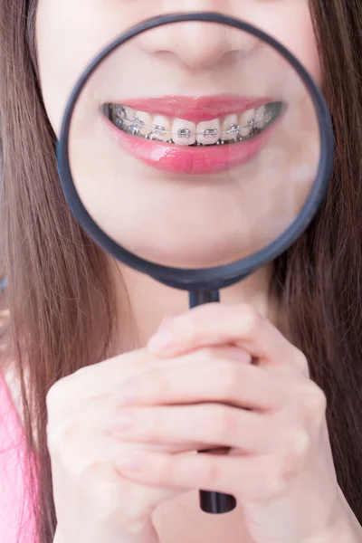 Woman Wearing Braces Holding Magnifying Glass Blue Background — Stock Photo, Image