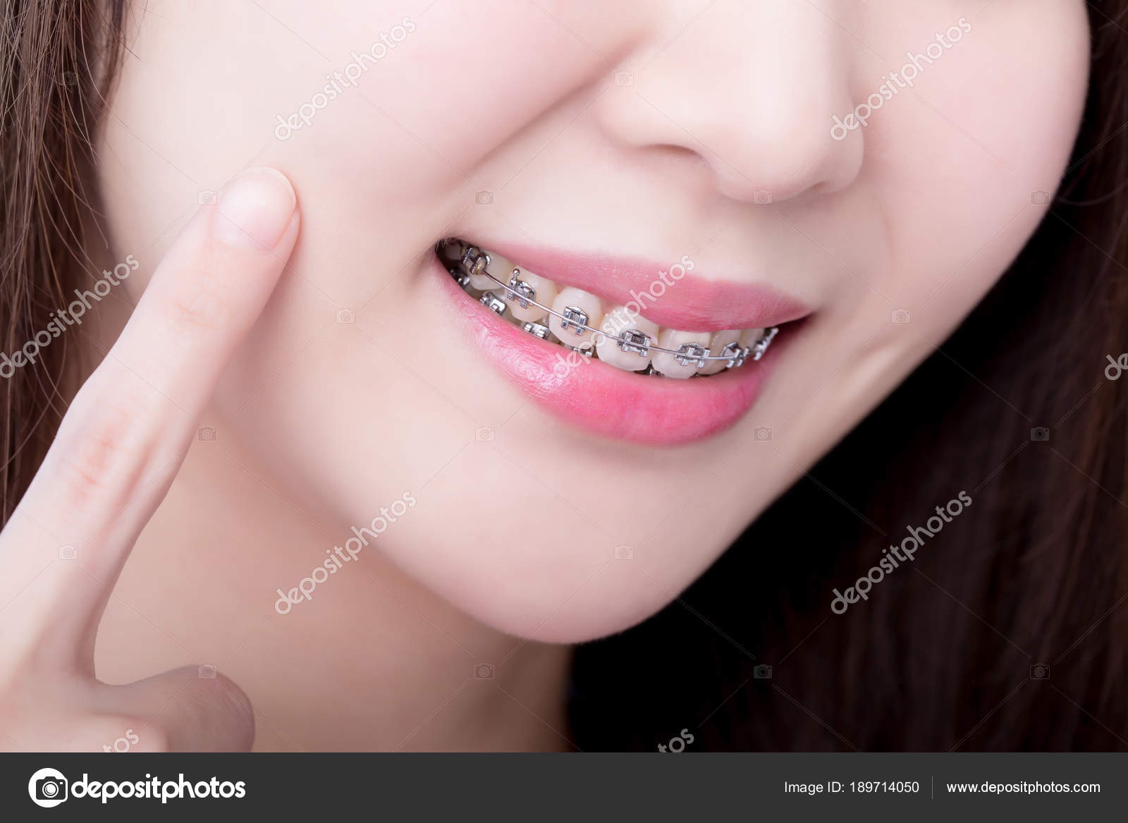 Close Asian Woman Wearing Braces Stock Photo by ©ryanking999 189714050
