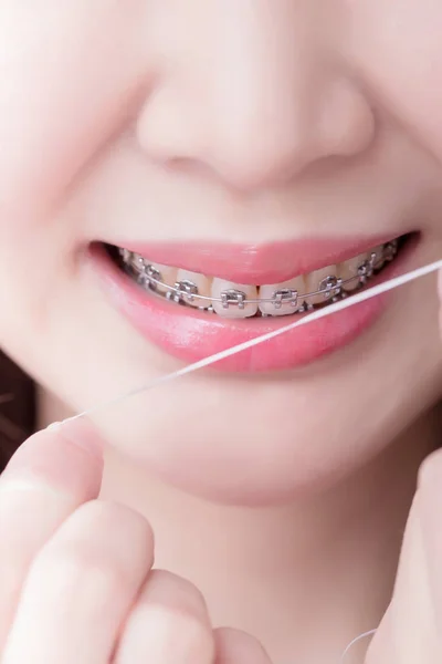 Mulher Usando Cinta Segurando Fio Dental — Fotografia de Stock