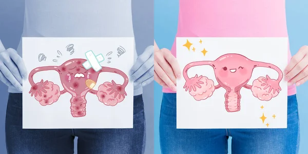 Werbetafeln Für Gesunde Und Ungesunde Gebärmutter Mit Gesundheitskonzept Auf Blauem — Stockfoto