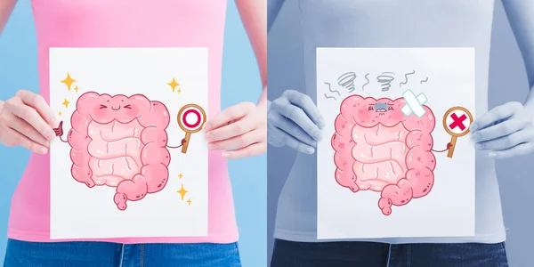 Carteleras Intestinales Saludables Poco Saludables Concepto Salud — Foto de Stock