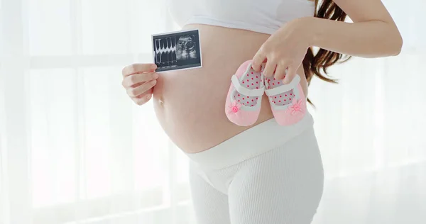 Mujer Sosteniendo Ultrasonido Bebé Zapatos Habitación — Foto de Stock