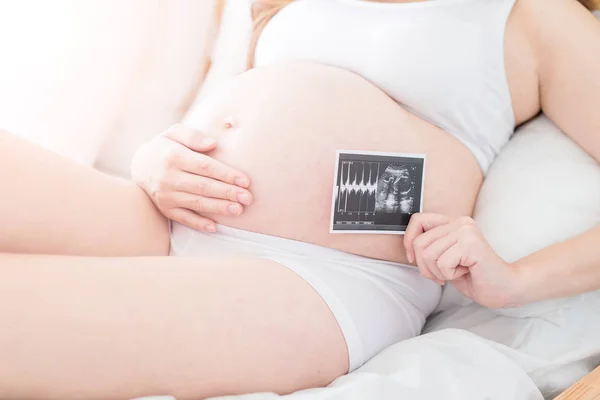 Gravid Kvinna Som Håller Barnet Ultraljud Bild Sängen — Stockfoto