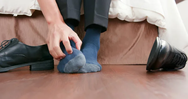 Man with athlete foot — Stock Photo, Image