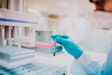 Doktor 2019 'da koronavirüs için pozitif test yapıyor.. 