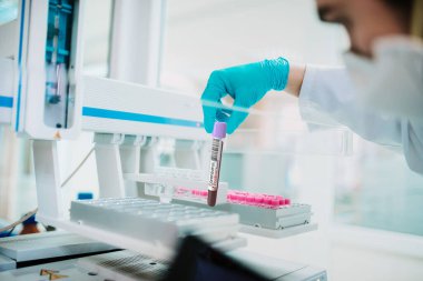 Laboratuvarda tıbbi doktor. Biyolojik bir tüp ile Covid19 bulaşıcı hastalığın analizi ve örneklenmesi için. Coronavirüs