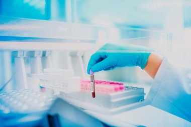 Doktorun elinde kovid19 için kanla pozitif test tüpü var..