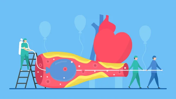 Cardiology vector illustration. This disease is narrowing of cor — 스톡 벡터