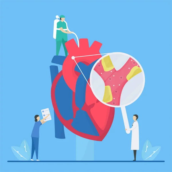 Cardiology vector illustration. This disease is narrowing of cor — 스톡 벡터