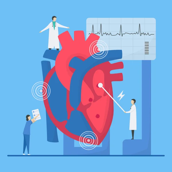 Ilustración Del Vector Cardiológico Este Problema Enfermedad Cardíaca Arritmia Diagnóstico — Archivo Imágenes Vectoriales