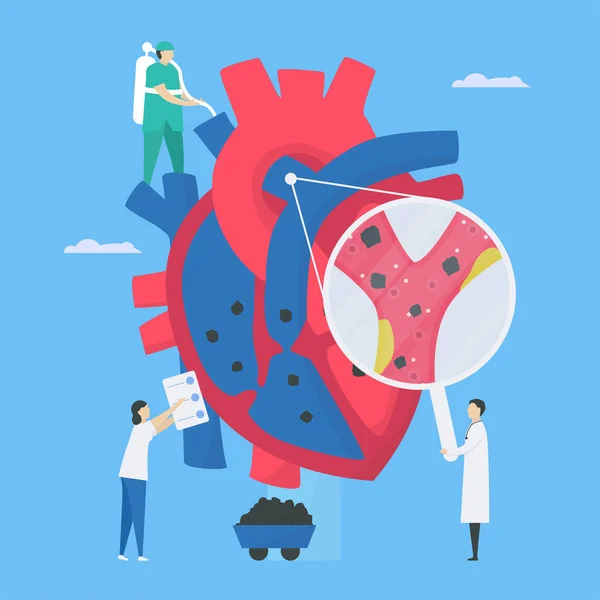 心臓病のベクターイラスト この病気は心内膜炎と呼ばれます それは内部の心臓室とバルブである心内膜の感染症です 患者をケアするために医師の診断と分析 — ストックベクタ