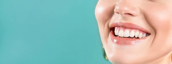 Smějící Žena Ústa Velkými Zuby Modrém Pozadí Zdravé Bílé Zuby — Stock fotografie