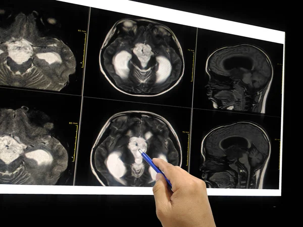 Εσωτερικη Χέρι Γιατρός Οδηγεί Μαγνητική Τομογραφία Εγκεφάλου Του Ασθενούς Στην — Φωτογραφία Αρχείου