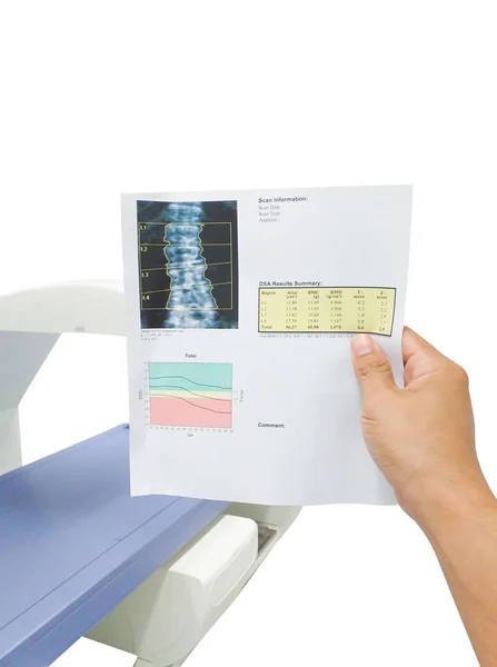 Examen especial Médico de la mano buscar resultados espina dorsal densidad ósea . — Foto de Stock