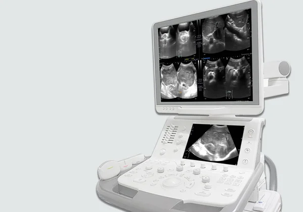 腹部超音波显示身体和腰椎间盘； — 图库照片