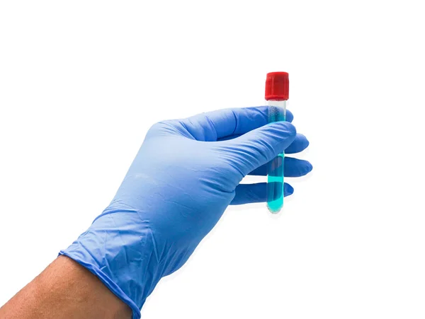 Closeup hand of a lab technician holding blood tube test — Stock Photo, Image