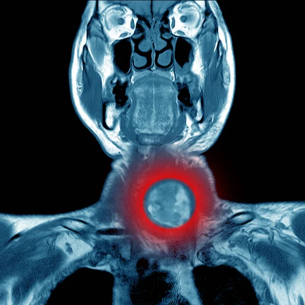 Μαγνητική τομογραφία (Mri) του λαιμού, — Φωτογραφία Αρχείου