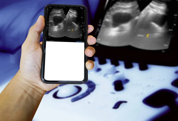 The doctor examined the abdominal ultrasound. With a smart phone. — Stok fotoğraf