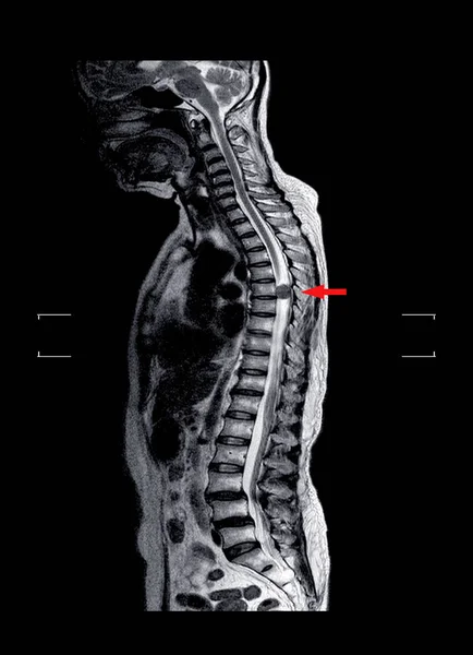 MRI omurgası. — Stok fotoğraf