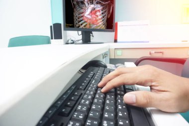 Klavyedeki bulanık el doktoru hastaya koroner CT anjiyografisi (CTA) sonucunu veriyor. LCD monitöründe arka planda görüntülendi. Tıbbi teknoloji konsepti..