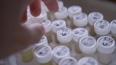 Bir el laboratuarda test için bir örnek seçer.