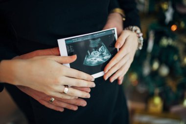 Hamile çift ultrason taraması yapıyor. Hamilelik sağlık hizmetleri kavramı.
