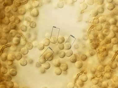 Many spores of a slime mold. Microscopy clipart
