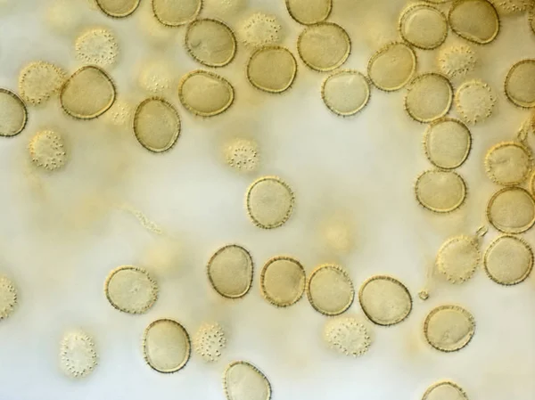 Spores of a slime mold. Microscopy — Stock Photo, Image