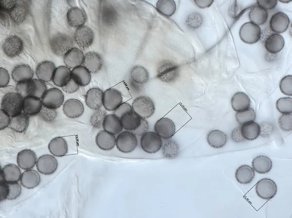 Spori di muffa melmosa. Microscopia — Foto Stock