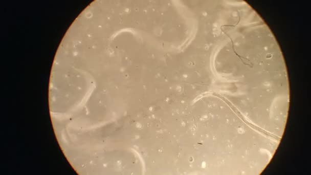 Close-up de micro-organismos ou micróbios na ampliação do microscópio. Macro, não animação 3D. Textura nano da placa de Petri no laboratório de microbiologia. Biografia conceitual abstrata. Zoom microscópico . — Vídeo de Stock