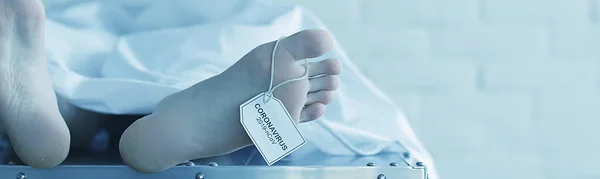 Concept Imitation Morgue Coronavirus Victim Killed 2019 Ncov Legs Corpse — Stock Photo, Image