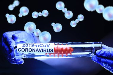 Kavram Coronavirus 2019-ncov, tüp bebek biyolojik tehlike testi virüsü.