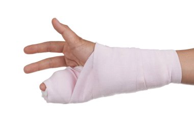 Tahta, kemik, el kırık kırık