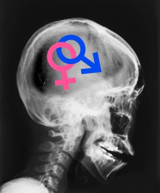 X-ray of head isolated with symbol sex inside. clipart