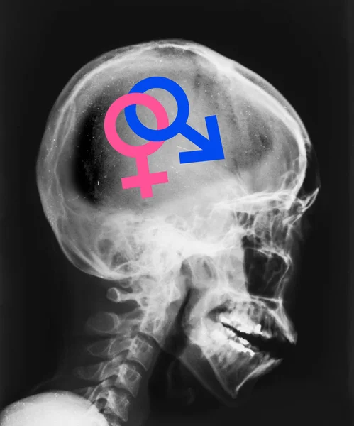 X-ray of head isolated with symbol sex inside. — Stock Photo, Image