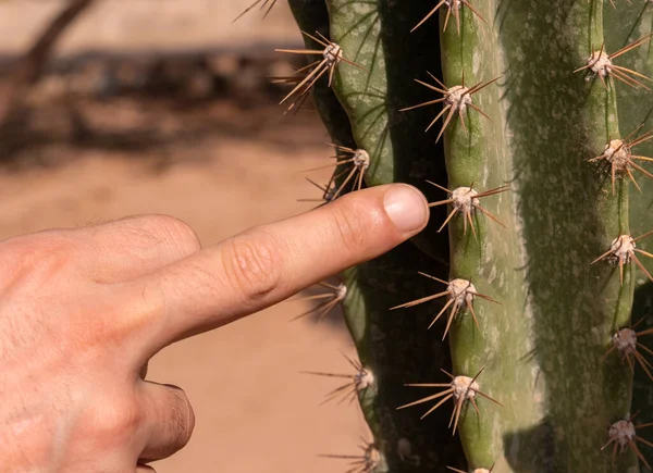 Mężczyzna Dotyka Kolczastych Kolców Kaktusa Ryzykowny Pochopny Gest Prawdopodobieństwo Urazu — Zdjęcie stockowe