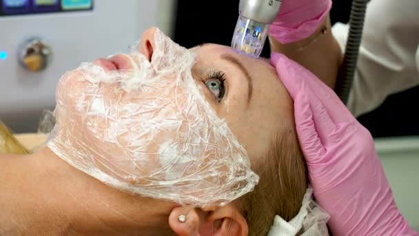 Fractionele Microneedle Radiofrequentieapparatuur Schoonheidsspecialiste Maken Van Huid Remodelleert Met Radiofrequentie — Stockvideo